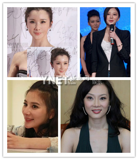盤點女星整容成敗 陳數(shù)整容變臉五官似孫儷