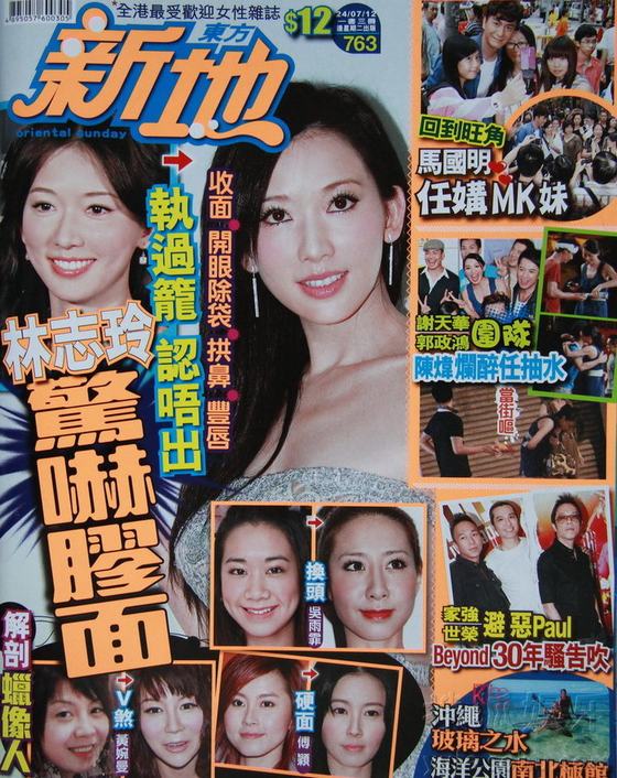 林志玲臉?biāo)葡炏駸o(wú)表情 逼近40大關(guān)極速整臉