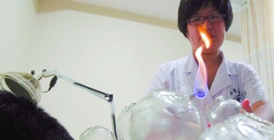 揭秘青島火療拔罐:蓋酒精毛巾引火上身 藍色火焰腿上跳