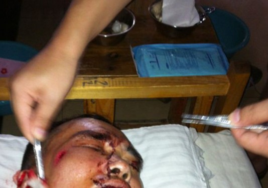 中鐵六局被曝雇黑社會群毆討薪民工 場面血腥