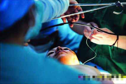 變性手術全程首度公開