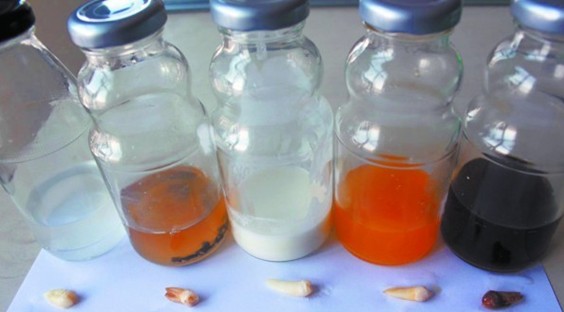 喝啥飲料最傷牙 實(shí)驗(yàn)證實(shí)可樂損傷牙釉質(zhì) 喝啥飲料最傷牙 實(shí)驗(yàn)證實(shí)可樂損傷牙釉質(zhì)