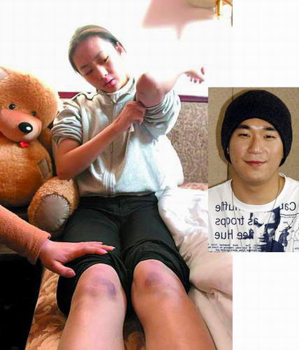 殘忍的明星家暴 太慘了！