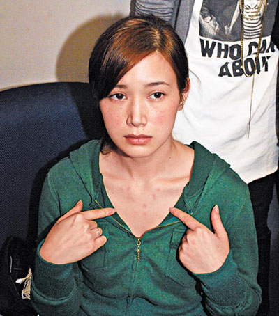 殘忍的明星家暴 太慘了！