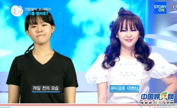 多圖劇透韓國整容節(jié)目《LET 美人》近幾期，最愛小V臉，人瘦就能美