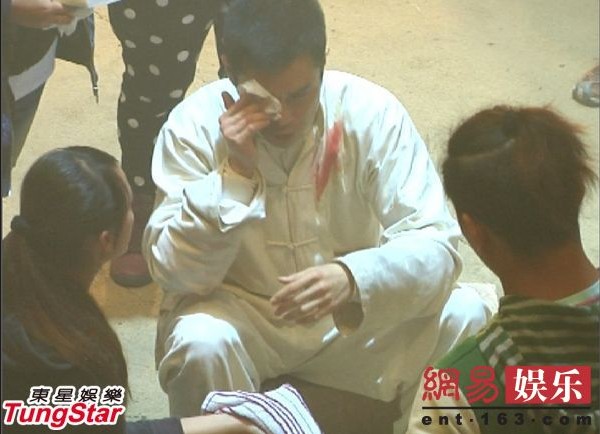 陳奕迅失足摔破睪丸成龍險(xiǎn)喪命 盤(pán)點(diǎn)明星“悲催”受傷史