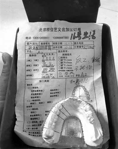 精佳藝義齒加工訂單顯示“反（返）工、重做”等字樣，一名骨干業(yè)務(wù)員說(shuō)，該廠產(chǎn)品返工率占兩成。