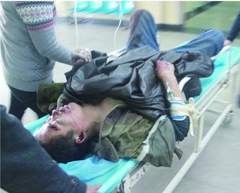 工人摔下腳手架顱骨塌陷 負(fù)責(zé)人竟笑稱小事