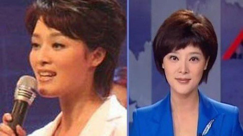 史上最全女主播整容前后對比照 網(wǎng)友：膜拜柳巖