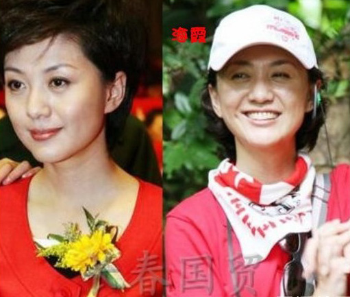 史上最全女主播整容前后對(duì)比照 網(wǎng)友：膜拜柳巖
