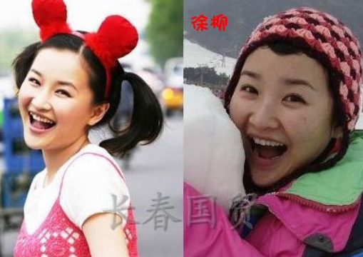 史上最全女主播整容前后對比照 網(wǎng)友：膜拜柳巖