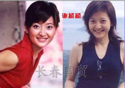 史上最全女主播整容前后對比照 網(wǎng)友：膜拜柳巖