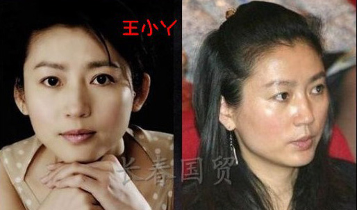 史上最全女主播整容前后對比照 網(wǎng)友：膜拜柳巖