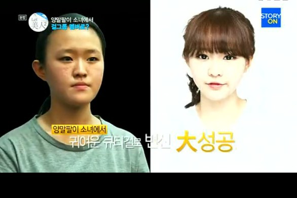 韓國整容節(jié)目驚現(xiàn)芭比娃娃 整容成癮3年100次手術(shù)