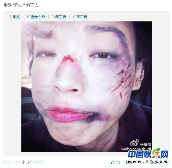 舒淇微博自曝受虐圖 網(wǎng)友：馮德倫恨你的過(guò)去(圖)