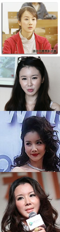 《北京青年》女星整容換臉照 網(wǎng)友：迎風流淚！