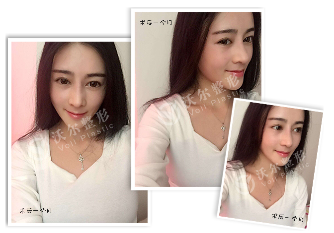 1486460014317009820.png 圖片4.png